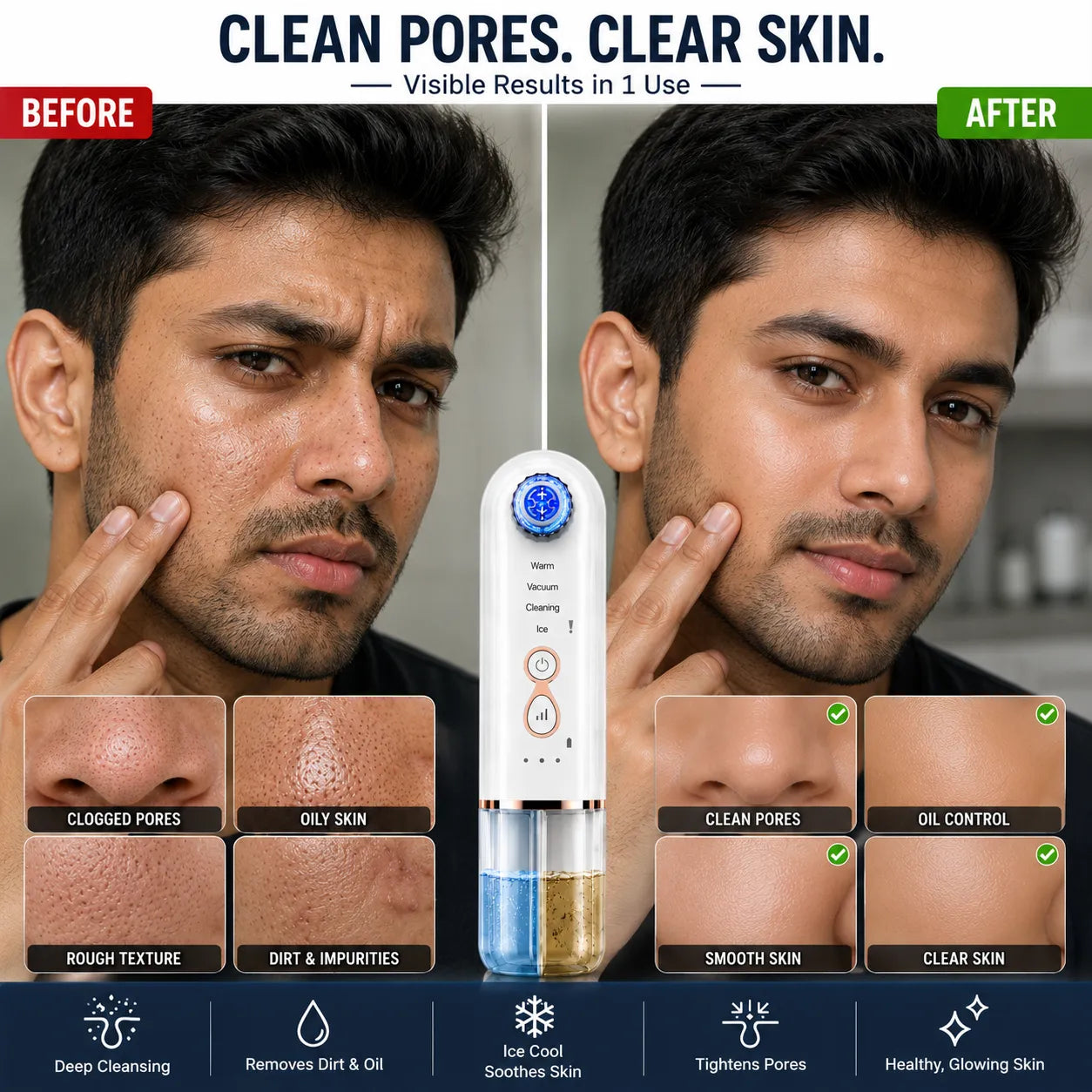 Hydra Facial Blackhead Removal Kit