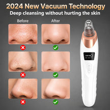 Hydra Facial Blackhead Removal Kit