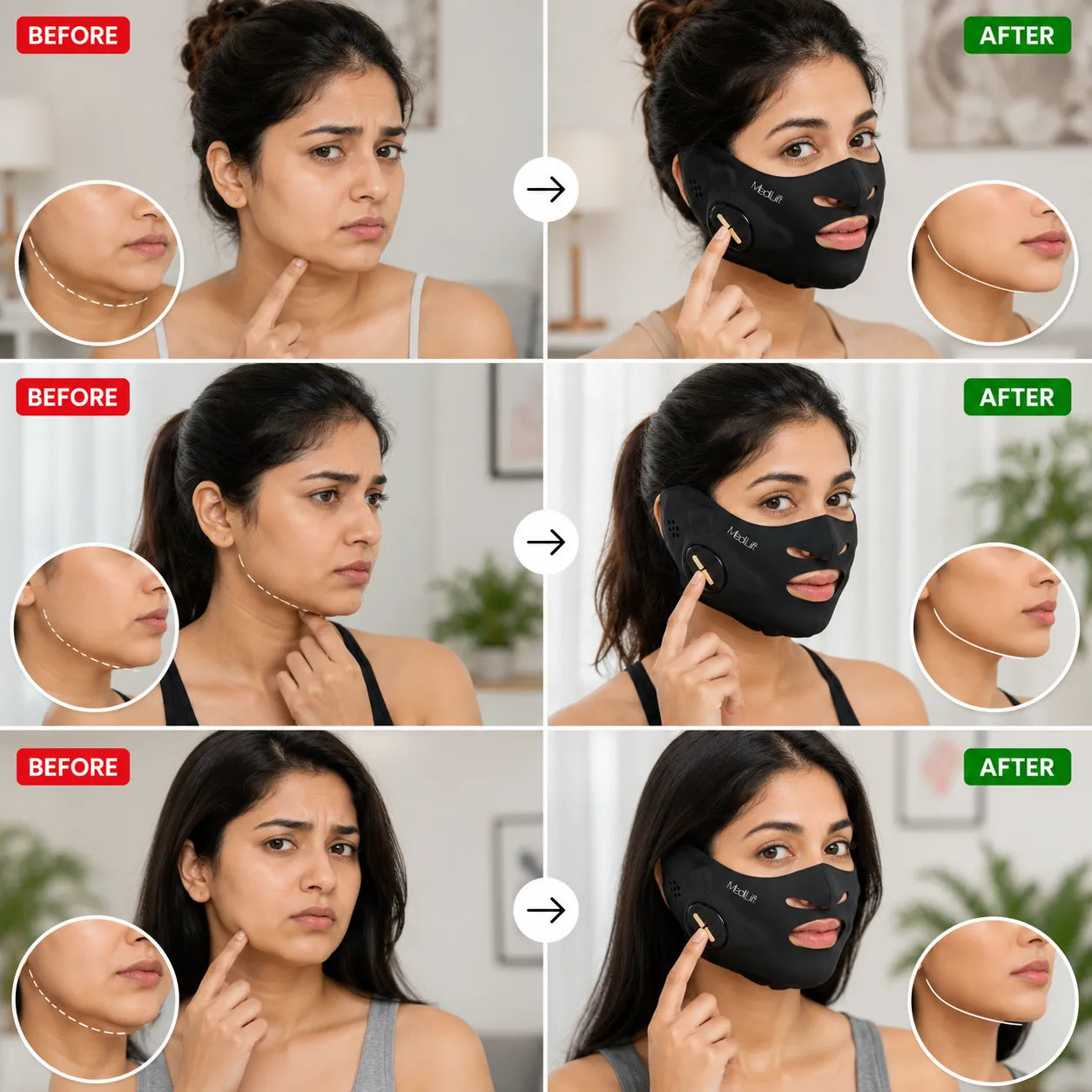 Reduction or complete disappearance of the double chin V-Face Massager
