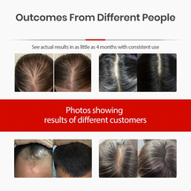 Hair Fall Control & Regrowth LED Therapy Cap