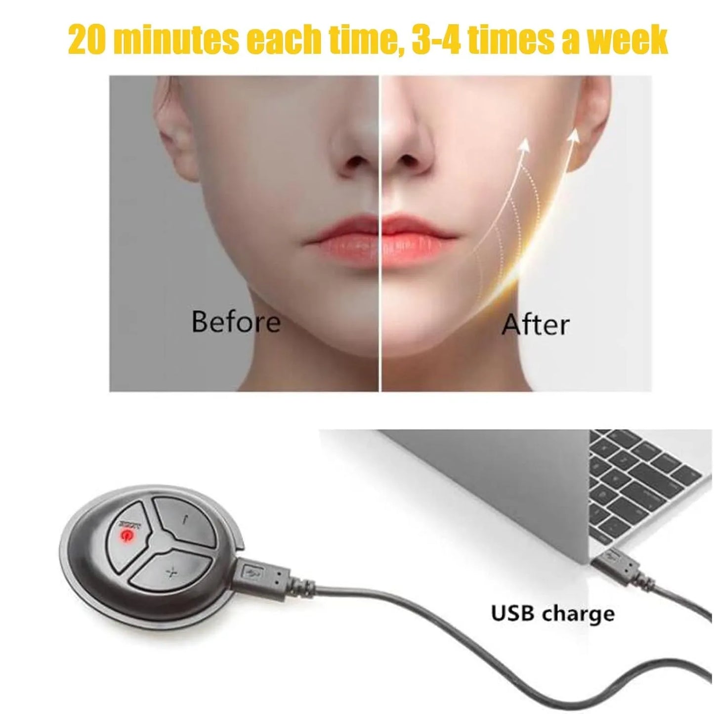 Reduction or complete disappearance of the double chin V-Face Massager