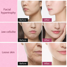 Face Lifting & Skin Tightening Massager