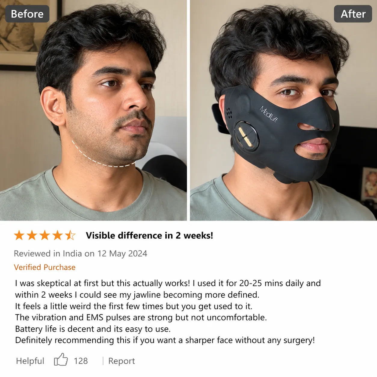 Reduction or complete disappearance of the double chin V-Face Massager