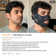 Reduction or complete disappearance of the double chin V-Face Massager