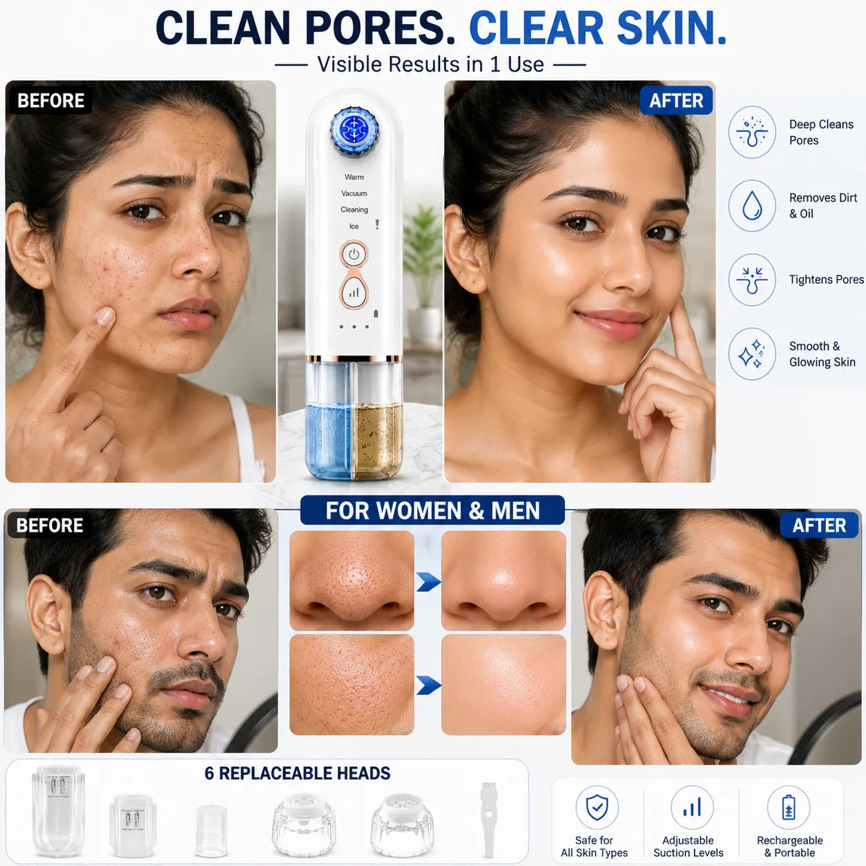Hydra Facial Blackhead Removal Kit
