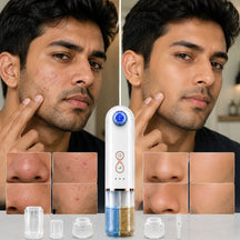 Hydra Facial Blackhead Removal Kit