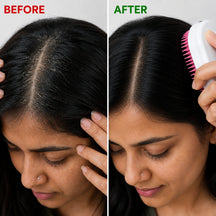 Electric Head Massager For Migraine Relief