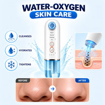 Hydra Facial Blackhead Removal Kit