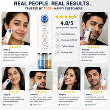 Hydra Facial Blackhead Removal Kit