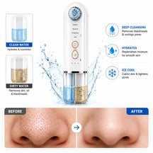 Hydra Facial Blackhead Removal Kit