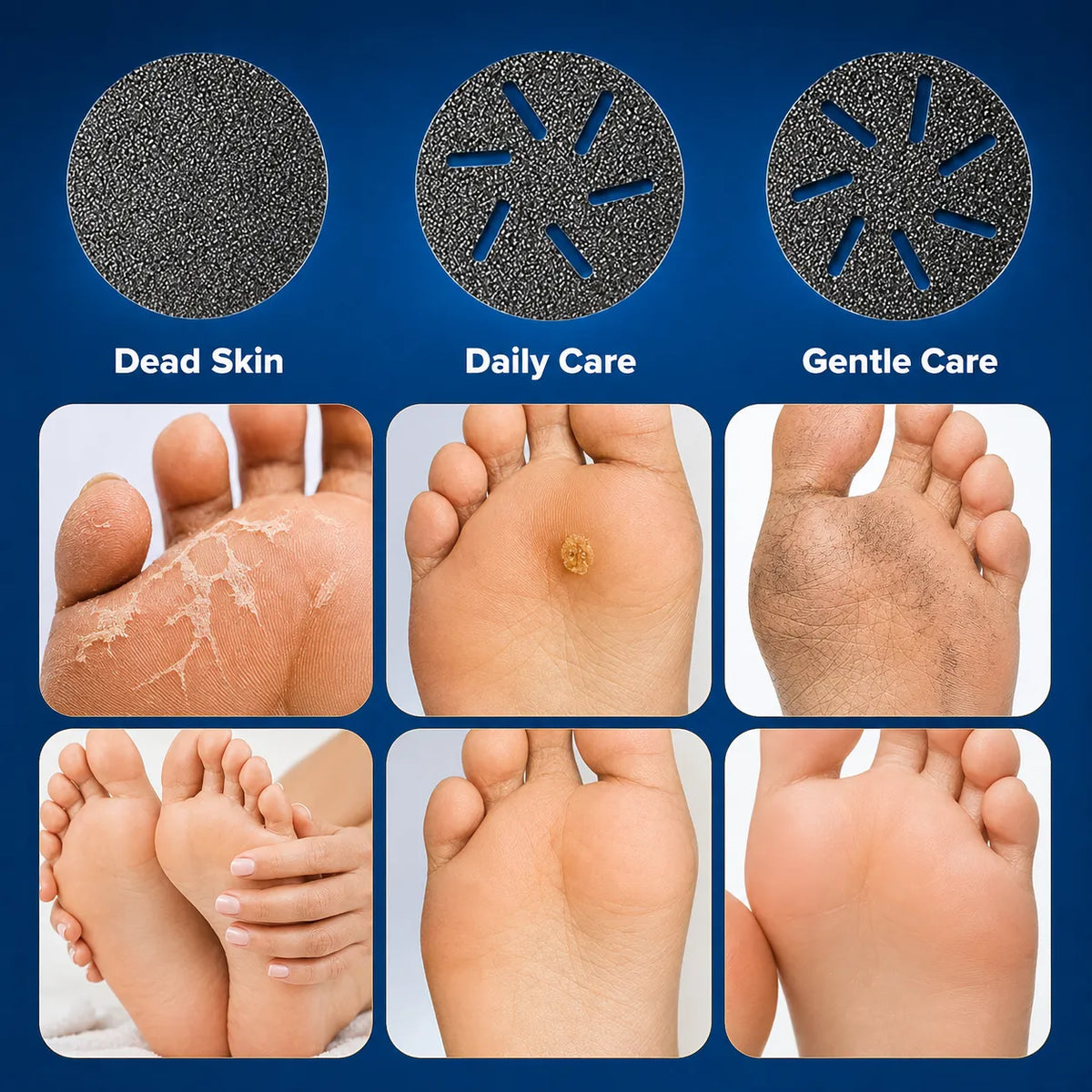 Electric Waterproof Pedicure Kit Rechargeable Calloused Feet Remover Tool with LCD Display for Efficient Exfoliation of Dead Skin on Feet