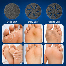 Electric Waterproof Pedicure Kit Rechargeable Calloused Feet Remover Tool with LCD Display for Efficient Exfoliation of Dead Skin on Feet