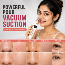 Hydra Facial Blackhead Removal Kit