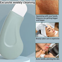 Stainless Steel Facial Acne Scraper (Pack of 2)