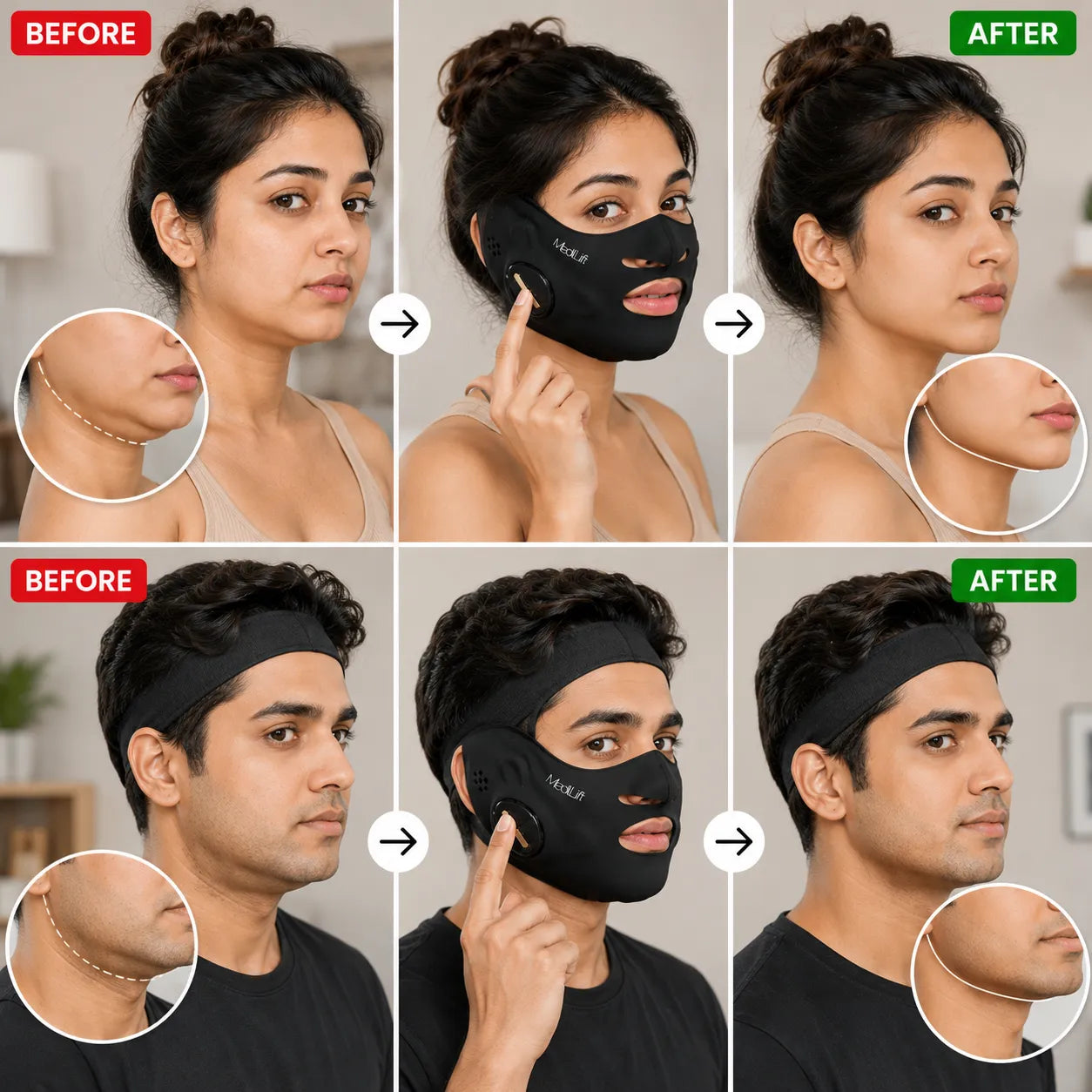 Reduction or complete disappearance of the double chin V-Face Massager